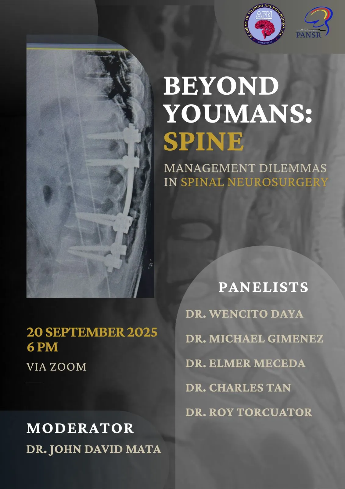 Beyond Youmans: Spine